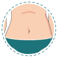 tummy tuck