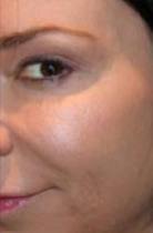 Woman\'s cheek with natural coloring after