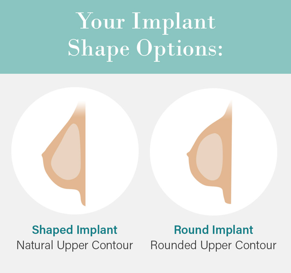 Breast implants can be shaped for a natural upper breast contour or round for a fuller upper breast contour